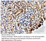 CD10 Antibody in Immunohistochemistry (IHC)