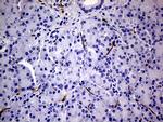 NES Antibody in Immunohistochemistry (Paraffin) (IHC (P))