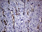 NES Antibody in Immunohistochemistry (Paraffin) (IHC (P))