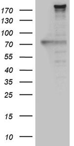 NES Antibody in Western Blot (WB)