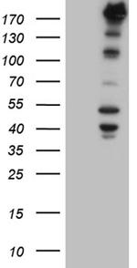 NES Antibody in Western Blot (WB)