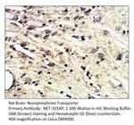 Norepinephrine Transporter Polyclonal Antibody