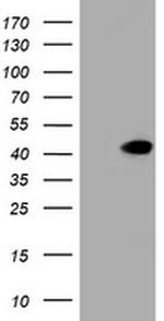 NEU1 Antibody in Western Blot (WB)