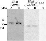 Estrogen Receptor beta Antibody in Western Blot (WB)