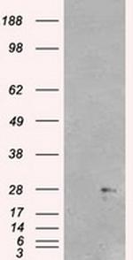 NEUROG1 Antibody in Western Blot (WB)