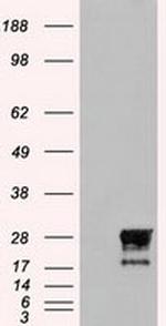 NEUROG1 Antibody in Western Blot (WB)
