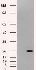 NEUROG1 Antibody in Western Blot (WB)