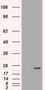 NEUROG1 Antibody in Western Blot (WB)