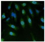NFAT5 Polyclonal Antibody