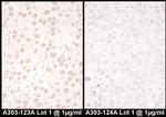NFIC Antibody in Immunohistochemistry (IHC)