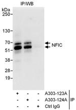 NFIC Antibody in Immunoprecipitation (IP)