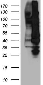 NFkB p52/p100 Antibody in Western Blot (WB)