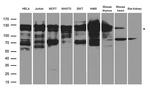NFkB p52/p100 Antibody in Western Blot (WB)