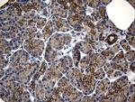 NFKBIE Antibody in Immunohistochemistry (Paraffin) (IHC (P))