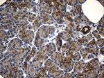 NFKBIE Antibody in Immunohistochemistry (Paraffin) (IHC (P))