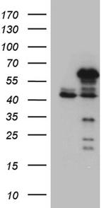 NFKBIE Antibody in Western Blot (WB)