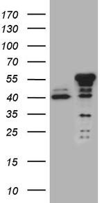 NFKBIE Antibody in Western Blot (WB)
