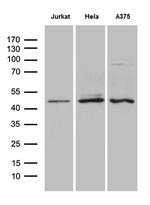 NFKBIE Antibody in Western Blot (WB)