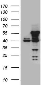 NFKBIE Antibody in Western Blot (WB)