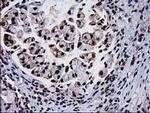 NHEJ1 Antibody in Immunohistochemistry (Paraffin) (IHC (P))