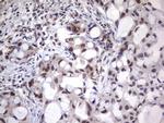 NHEJ1 Antibody in Immunohistochemistry (Paraffin) (IHC (P))