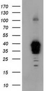 NHEJ1 Antibody in Western Blot (WB)