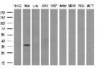 NHEJ1 Antibody in Western Blot (WB)