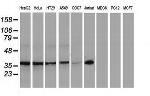 NHEJ1 Antibody in Western Blot (WB)