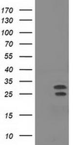 NHEJ1 Antibody in Western Blot (WB)