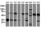 NHEJ1 Antibody in Western Blot (WB)