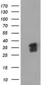 NHEJ1 Antibody in Western Blot (WB)