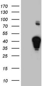 NHEJ1 Antibody in Western Blot (WB)