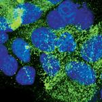 EBP50 Polyclonal Antibody