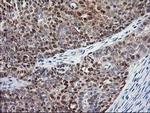 NIF3L1 Antibody in Immunohistochemistry (Paraffin) (IHC (P))
