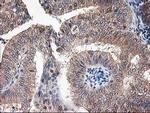 NIF3L1 Antibody in Immunohistochemistry (Paraffin) (IHC (P))