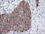NIF3L1 Antibody in Immunohistochemistry (Paraffin) (IHC (P))