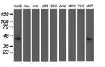 NIF3L1 Antibody in Western Blot (WB)