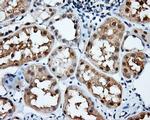 NIT2 Antibody in Immunohistochemistry (Paraffin) (IHC (P))