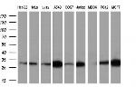 NIT2 Antibody in Western Blot (WB)