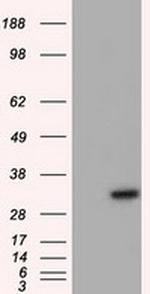 NIT2 Antibody in Western Blot (WB)