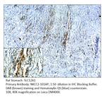 SLC12A1 Polyclonal Antibody