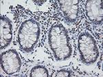 NKIRAS1 Antibody in Immunohistochemistry (Paraffin) (IHC (P))
