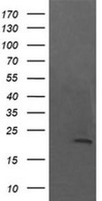NKIRAS1 Antibody in Western Blot (WB)