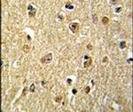 NKRF Antibody in Immunohistochemistry (IHC)