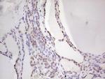 NKX2 Antibody in Immunohistochemistry (Paraffin) (IHC (P))