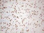 NKX2 Antibody in Immunohistochemistry (Paraffin) (IHC (P))
