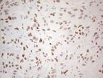 NKX2 Antibody in Immunohistochemistry (Paraffin) (IHC (P))