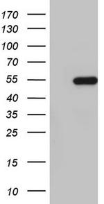NKX2 Antibody in Western Blot (WB)