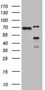 NKX2 Antibody in Western Blot (WB)