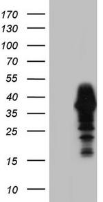 NKX3.1 Antibody in Western Blot (WB)